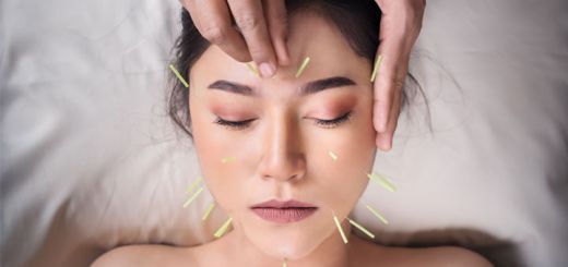 acupuncture-alleviates-anxiety